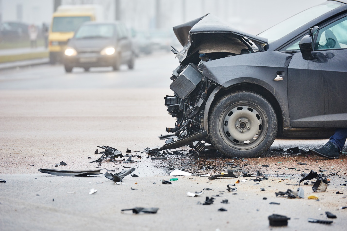 montgomery car accident attorneys 1 - What Should I Do if I Was Injured in a Car Accident in Alabama?